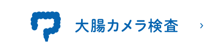 大腸カメラ検査（大腸内視鏡検査）